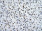 HNRPA0 antibody - middle region